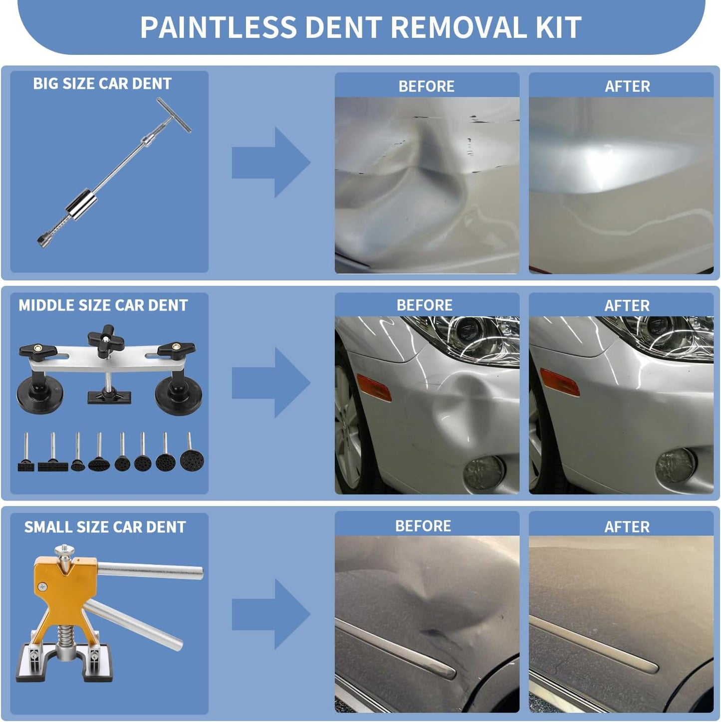 97PCS Dent Puller Kit, Paintless Auto Body Dent Repair Kit with Golden Lifter, Slide Hammer T-Bar Dent Puller, Bridge Puller, Suction Cup and Glue Gun for Car Dent Remove Auto Body Dent Removal Kit