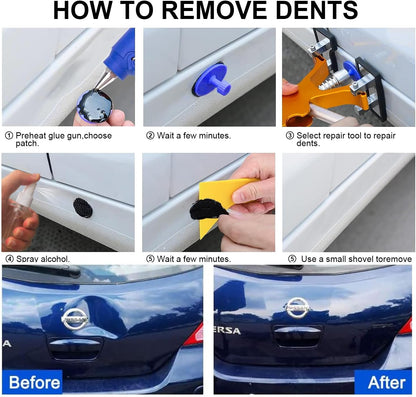 Car Dent Puller Repair Kit - Paintless Dent Repair Tools with Golden Lifter - Universal Auto Body Dent Repair Tool, Slide Hammer and Glue Gun for Large & Small Ding Hail Dent Remover